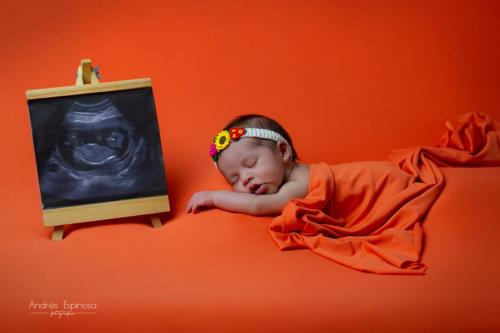 Newborn - Bebe durmiendo con ecografía